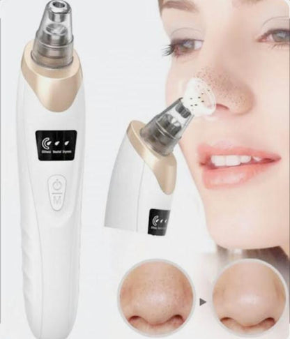 5 in 1 Electric Rechargeable Black Head Remover