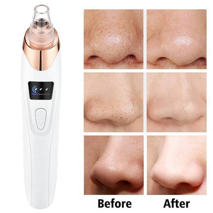 5 in 1 Electric Rechargeable Black Head Remover